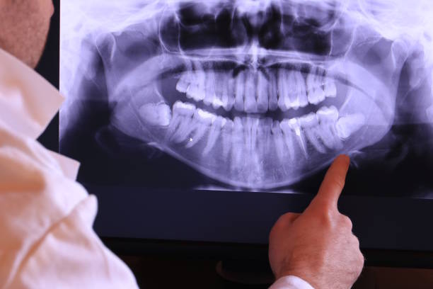 Best Broken or Cracked Tooth Emergency Dentist in Greenville, TX