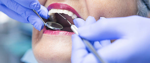 Best Emergency Dentist for Lost Fillings or Crowns in Greenville, TX